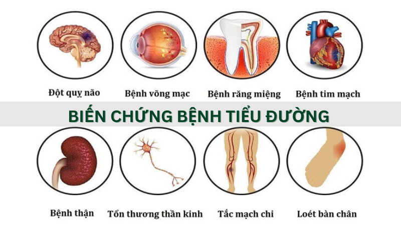 Một số biến chứng thường gặp ở người bệnh tiểu đường